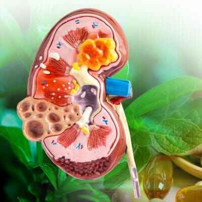 ayurvedic kidney treatment