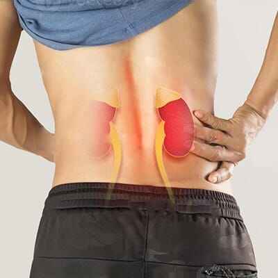 ayurvedic kidney treatment