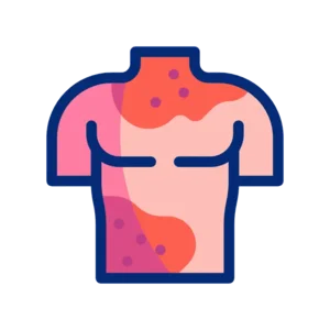 Natural Psoriasis Treatment