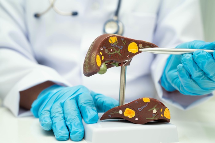 Natural Fatty Liver Treatment